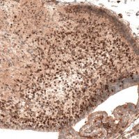 Monoclonal Anti-AUTS2 antibody produced in mouse 