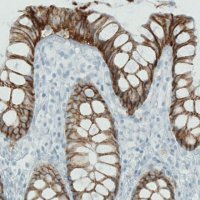 Monoclonal Anti-CA12 antibody produced in mouse