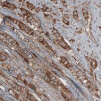 Monoclonal Anti-CARS antibody produced in mouse 