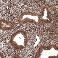 Monoclonal Anti-CDK4 antibody produced in mouse AMAB91499-100UL