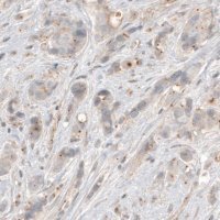 Monoclonal Anti-CDK5RAP2 antibody produced in mouse 