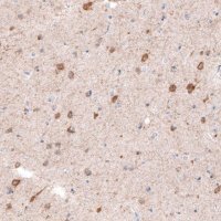 Monoclonal Anti-CDKL5 antibody produced in mouse 
