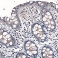 Monoclonal Anti-CEP350 antibody produced in mouse 