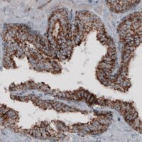 Monoclonal Anti-CS antibody produced in mouse 