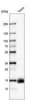 Monoclonal Anti-CTAG1B antibody produced in mouse AMAB91606-100UL