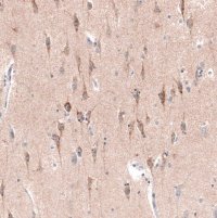 Monoclonal Anti-CTGF antibody produced in mouse 