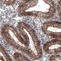 Monoclonal Anti-CTNNB1 antibody produced in mouse 