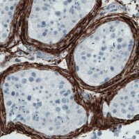 Monoclonal Anti-FBN1 antibody produced in mouse 
