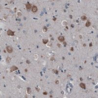 Monoclonal Anti-GORASP2 antibody produced in mouse 
