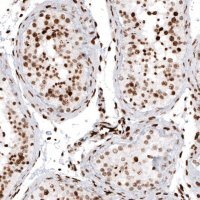 Monoclonal Anti-HIST1H2AG antibody produced in mouse 