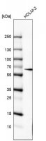 Monoclonal Anti-IL10RA antibody produced in mouse AMAB91503-100UL