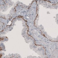 Monoclonal Anti-LAMB3 antibody produced in mouse 