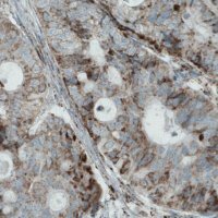 Monoclonal Anti-MACC1 antibody produced in mouse 