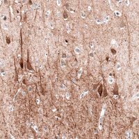 Monoclonal Anti-MAP2 antibody produced in mouse 