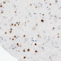 Monoclonal Anti-MEF2C antibody produced in mouse 