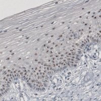 Monoclonal Anti-MKI67IP antibody produced in mouse 