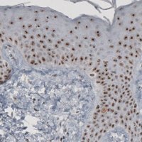 Monoclonal Anti-MKI67IP from mouse 