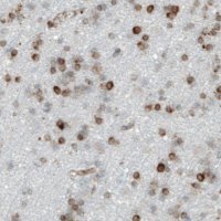 Monoclonal Anti-MTDH antibody produced in mouse 