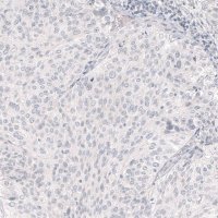 Monoclonal Anti-NANOG antibody produced in mouse 