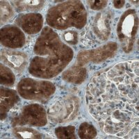 Monoclonal Anti-NAPRT antibody produced in mouse 