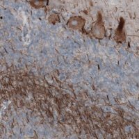 Monoclonal Anti-NEFH antibody produced in mouse 