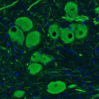 Monoclonal Anti-NEFM antibody produced in mouse 