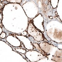 Monoclonal Anti-PAX8 antibody produced in mouse AMAB91488-100UL