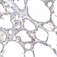 Monoclonal Anti-PIK3CB antibody produced in mouse AMAB91585-100UL