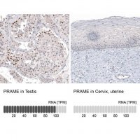 Monoclonal Anti-PRAME antibody produced in mouse 
