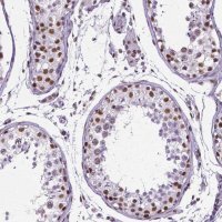Monoclonal Anti-REST antibody produced in mouse 