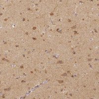 Monoclonal Anti-RHOT1 antibody produced in mouse 