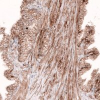 Monoclonal Anti-ROR2 antibody produced in mouse 