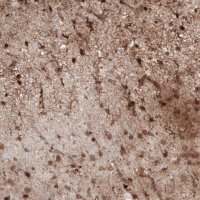 Monoclonal Anti-S100B antibody produced in mouse 