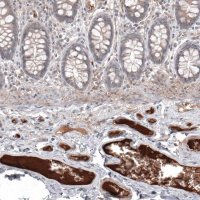 Monoclonal Anti-SAA1 antibody produced in mouse AMAB91543-100UL