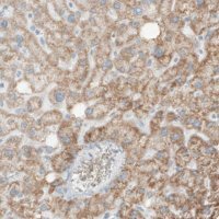 Monoclonal Anti-SDHB antibody produced in mouse 
