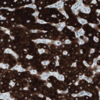 Monoclonal Anti-SLC27A5 antibody produced in mouse 