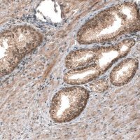 Monoclonal Anti-SMAD4 antibody produced in mouse AMAB91594-100UL