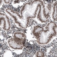Monoclonal Anti-SMCHD1 antibody produced in mouse