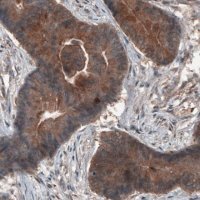 Monoclonal Anti-ST13 antibody produced in mouse 