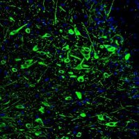 Monoclonal Anti-TPH2 antibody produced in mouse 