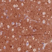 Monoclonal Anti-TSPAN7 antibody produced in mouse 