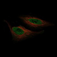 Monoclonal Anti-ZNF10 antibody produced in mouse AMAB91592-100UL