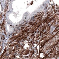 Monoclonal Anti-ZYX antibody produced in mouse 