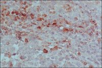Anti-Horse IgG (whole molecule)Peroxidase antibody produced in rabbit A9292-2ML