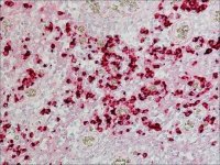 Anti-Human IgA (-chain specific)Alkaline Phosphatase antibody produced in goat 