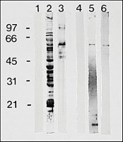 Anti-Human IgG (-chain specific)Peroxidase antibody produced in goat 