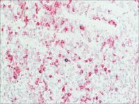 Anti-Human IgG (Fab specific)Alkaline Phosphatase antibody produced in goat 