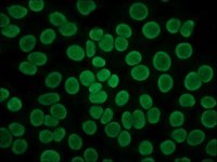 Anti-Human IgG (Fab specific)FITC antibody produced in goat 