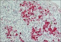 Anti-Human IgG (Fc specific)Alkaline Phosphatase antibody produced in goat 
