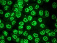 Anti-Human IgG (whole molecule)FITC antibody produced in goat 